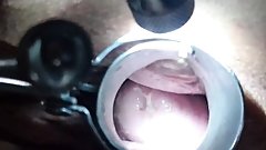 Speculum play in my pussy