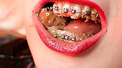 ASMR mukbang FOOD FETISH eating video close up with BRACES