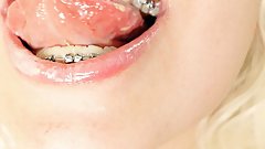 BRACES fetish - ASMR clip of eating MUKBANG...